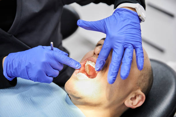 Professional Emergency Dental Service in CA